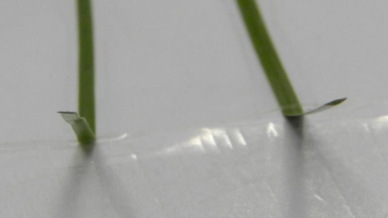 Elastic Fibers